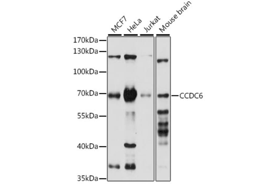 Western Blot - Anti-CCDC6 Antibody (A308478) - Antibodies.com
