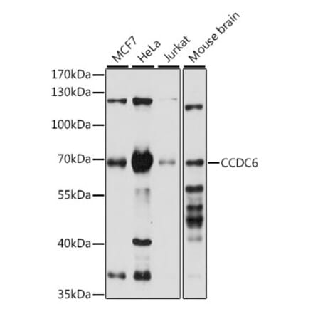 Western Blot - Anti-CCDC6 Antibody (A308478) - Antibodies.com