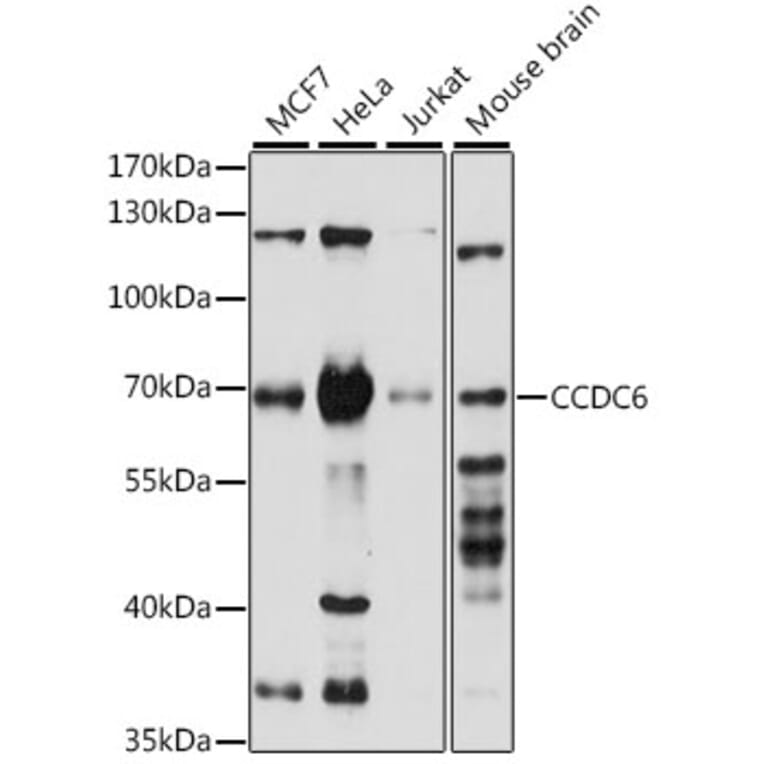 Western Blot - Anti-CCDC6 Antibody (A308478) - Antibodies.com