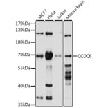 Western Blot - Anti-CCDC6 Antibody (A308478) - Antibodies.com