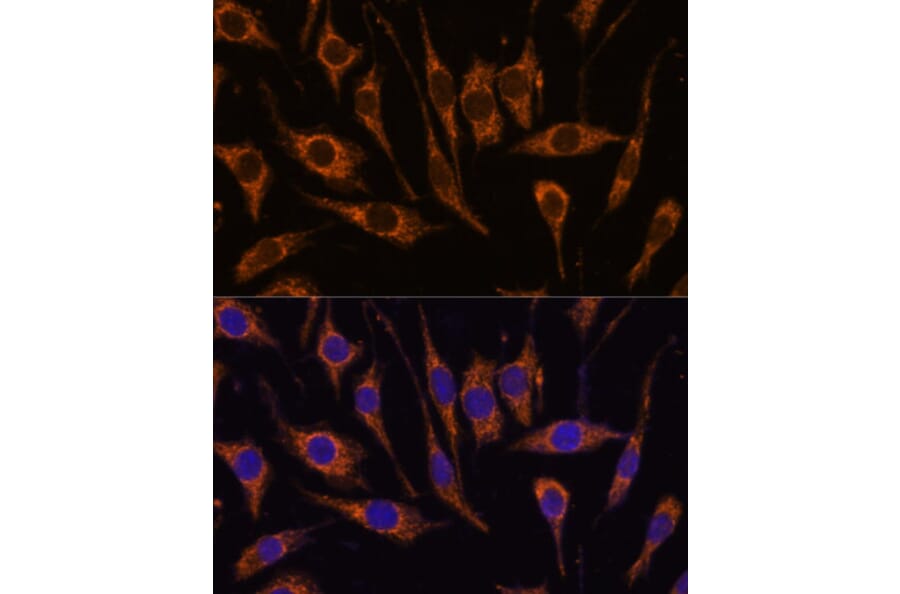 Immunofluorescence - Anti-CCDC6 Antibody (A308478) - Antibodies.com
