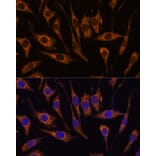 Immunofluorescence - Anti-CCDC6 Antibody (A308478) - Antibodies.com