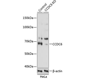 Western Blot - Anti-CCDC6 Antibody (A308479) - Antibodies.com