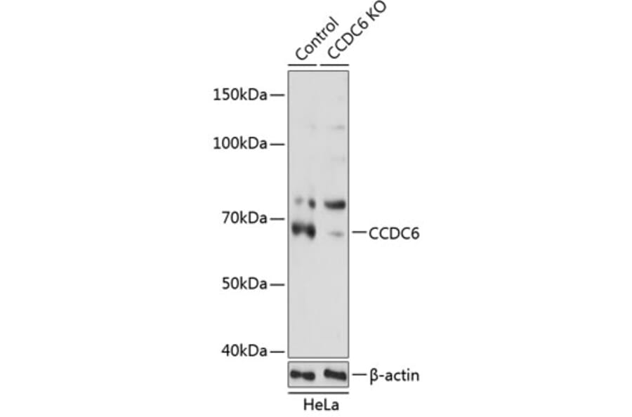 Western Blot - Anti-CCDC6 Antibody (A308479) - Antibodies.com