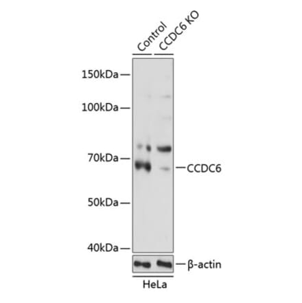 Western Blot - Anti-CCDC6 Antibody (A308479) - Antibodies.com