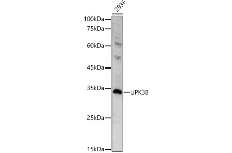 Western Blot - Anti-Uroplakin IIIB Antibody (A308480) - Antibodies.com