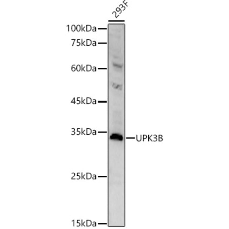 Western Blot - Anti-Uroplakin IIIB Antibody (A308480) - Antibodies.com