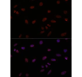 Immunofluorescence - Anti-TTF1 Antibody (A308481) - Antibodies.com