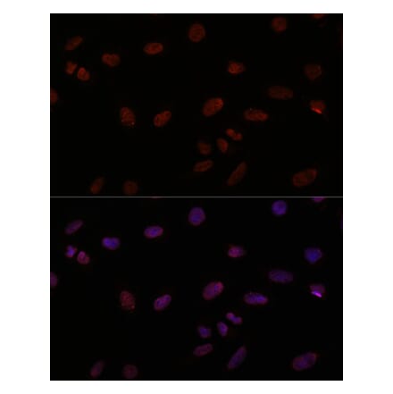 Immunofluorescence - Anti-TTF1 Antibody (A308481) - Antibodies.com