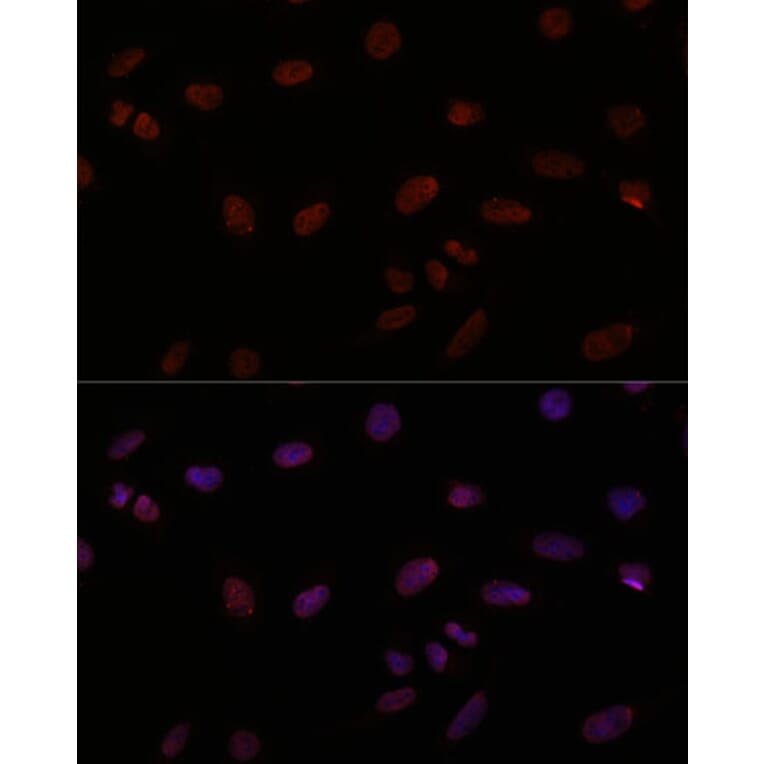 Immunofluorescence - Anti-TTF1 Antibody (A308481) - Antibodies.com