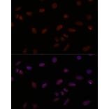 Immunofluorescence - Anti-TTF1 Antibody (A308481) - Antibodies.com