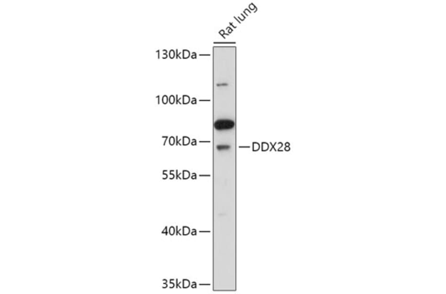 Western Blot - Anti-DDX28 Antibody (A308482) - Antibodies.com