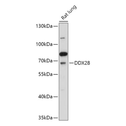 Western Blot - Anti-DDX28 Antibody (A308482) - Antibodies.com