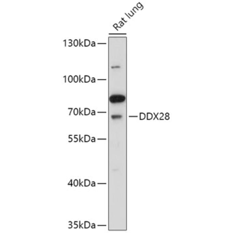Western Blot - Anti-DDX28 Antibody (A308482) - Antibodies.com