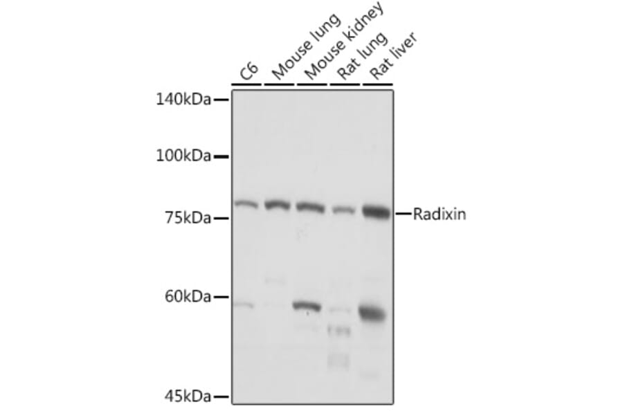 Western Blot - Anti-Radixin/RDX Antibody [ARC2277] (A308483) - Antibodies.com