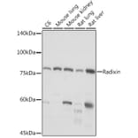 Western Blot - Anti-Radixin/RDX Antibody [ARC2277] (A308483) - Antibodies.com