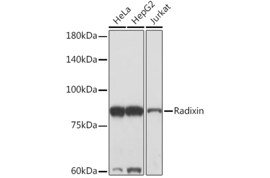 Western Blot - Anti-Radixin/RDX Antibody [ARC2277] (A308483) - Antibodies.com