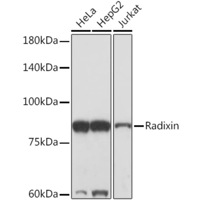 Western Blot - Anti-Radixin/RDX Antibody [ARC2277] (A308483) - Antibodies.com