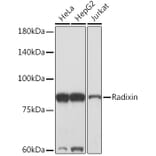 Western Blot - Anti-Radixin/RDX Antibody [ARC2277] (A308483) - Antibodies.com