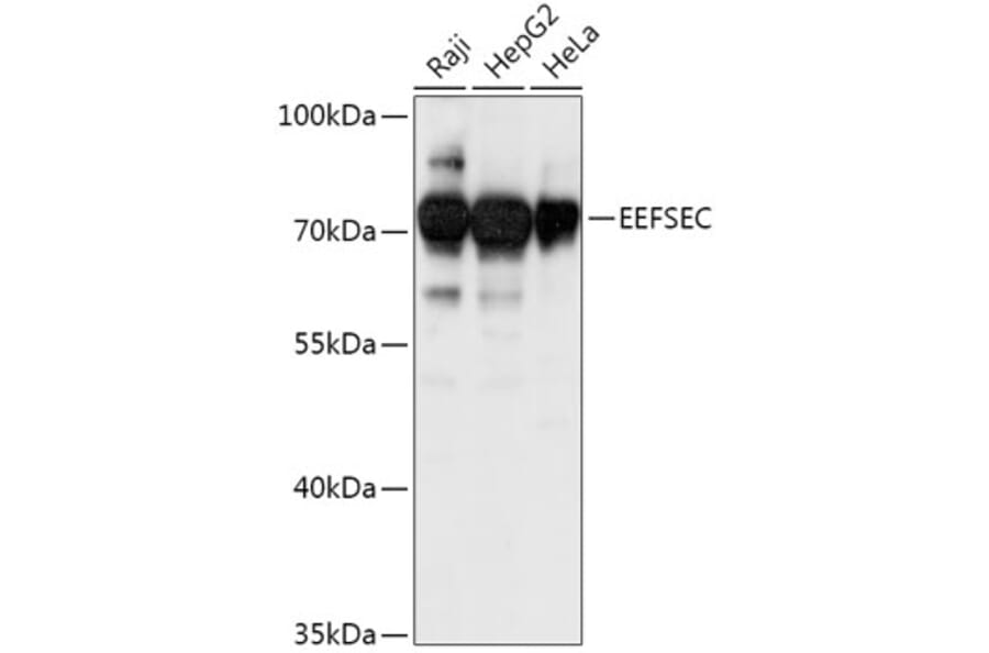Western Blot - Anti-EEFSEC Antibody (A308484) - Antibodies.com