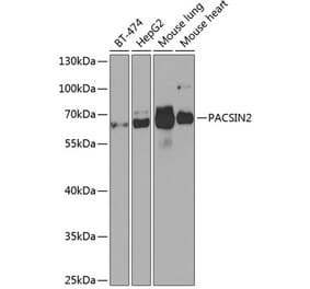 Western Blot - Anti-PACSIN2 Antibody (A308485) - Antibodies.com