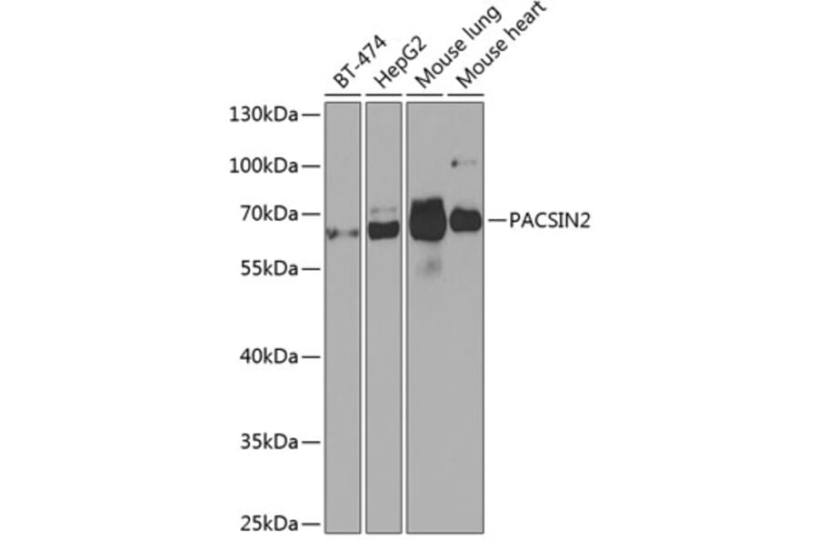 Western Blot - Anti-PACSIN2 Antibody (A308485) - Antibodies.com