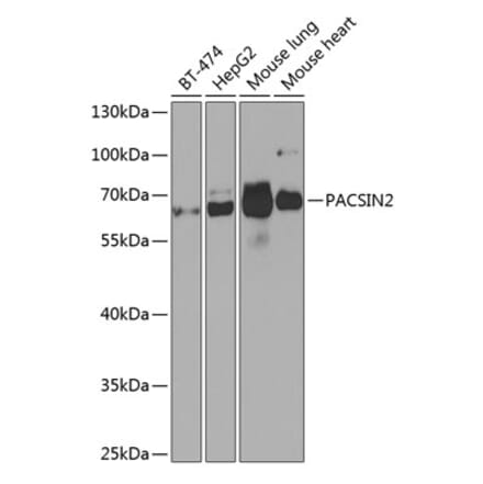 Western Blot - Anti-PACSIN2 Antibody (A308485) - Antibodies.com