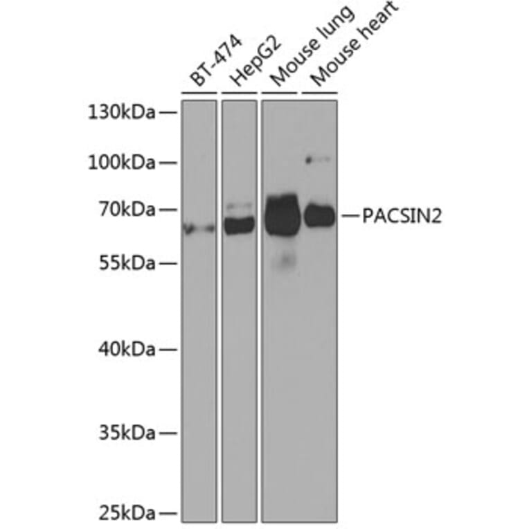 Western Blot - Anti-PACSIN2 Antibody (A308485) - Antibodies.com