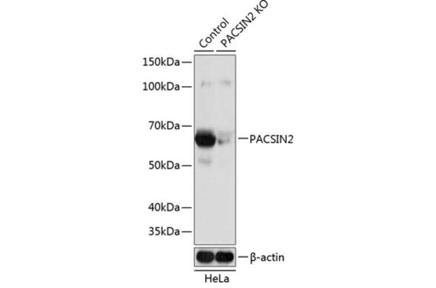 Western Blot - Anti-PACSIN2 Antibody (A308486) - Antibodies.com