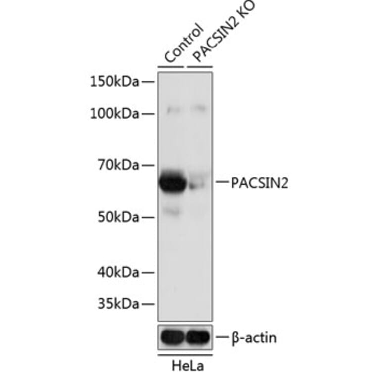 Western Blot - Anti-PACSIN2 Antibody (A308486) - Antibodies.com