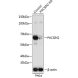 Western Blot - Anti-PACSIN2 Antibody (A308486) - Antibodies.com
