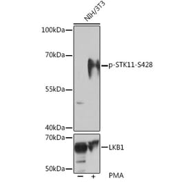 Western Blot - Anti-LKB1 (phospho Ser428) Antibody (A308488) - Antibodies.com