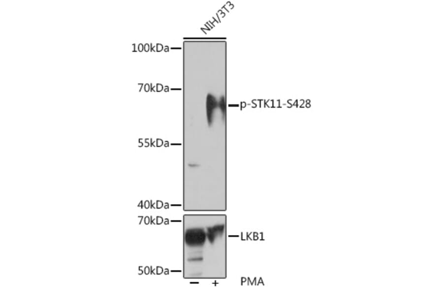 Western Blot - Anti-LKB1 (phospho Ser428) Antibody (A308488) - Antibodies.com