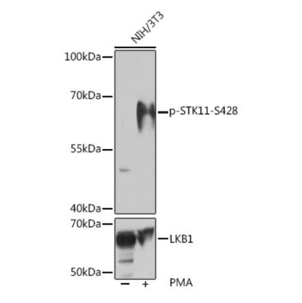 Western Blot - Anti-LKB1 (phospho Ser428) Antibody (A308488) - Antibodies.com