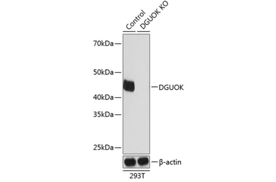 Western Blot - Anti-dGK Antibody (A308489) - Antibodies.com