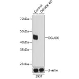 Western Blot - Anti-dGK Antibody (A308489) - Antibodies.com