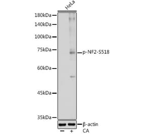Western Blot - Anti-NF2 / Merlin (phospho Ser518) Antibody (A308490) - Antibodies.com