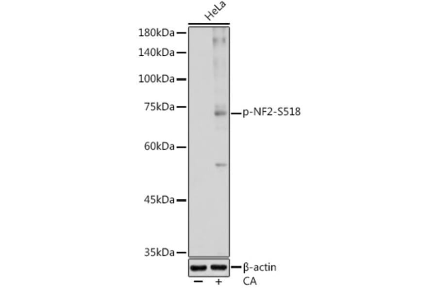 Western Blot - Anti-NF2/Merlin (phospho Ser518) Antibody (A308490) - Antibodies.com