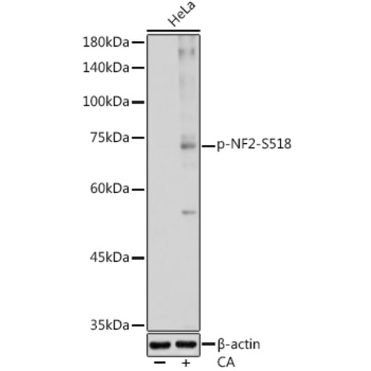 Western Blot - Anti-NF2/Merlin (phospho Ser518) Antibody (A308490) - Antibodies.com