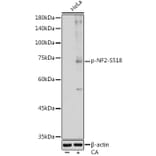 Western Blot - Anti-NF2/Merlin (phospho Ser518) Antibody (A308490) - Antibodies.com