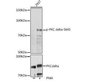 Western Blot - Anti-PKC delta (phospho Ser645) Antibody (A308494) - Antibodies.com