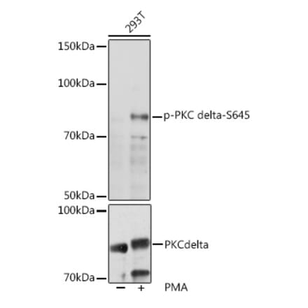 Western Blot - Anti-PKC delta (phospho Ser645) Antibody (A308494) - Antibodies.com