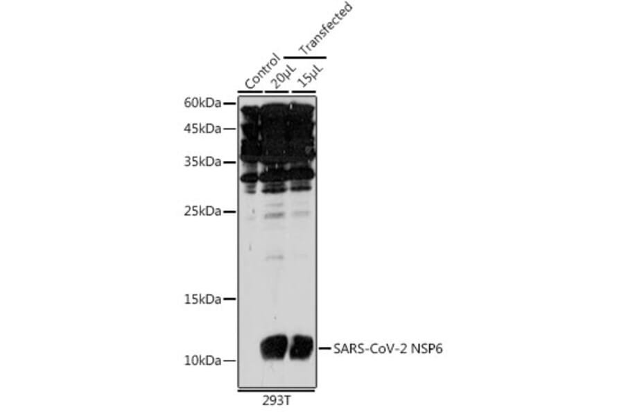 Western Blot - Anti-SARS-CoV2 NSP6 Antibody (A308495) - Antibodies.com