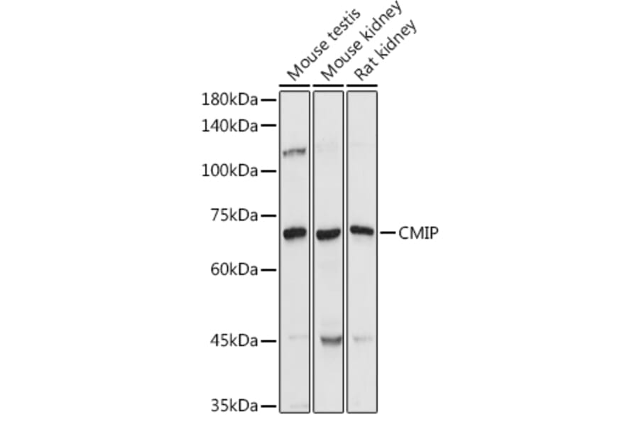 Western Blot - Anti-CMIP Antibody (A308496) - Antibodies.com