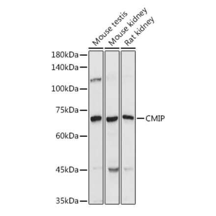 Western Blot - Anti-CMIP Antibody (A308496) - Antibodies.com