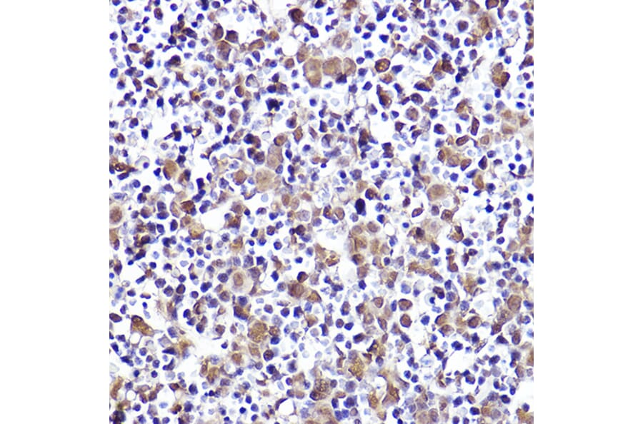 Immunohistochemistry - Anti-CMIP Antibody (A308496) - Antibodies.com
