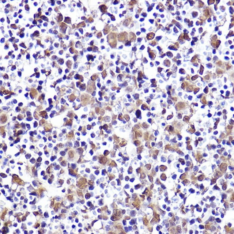 Immunohistochemistry - Anti-CMIP Antibody (A308496) - Antibodies.com