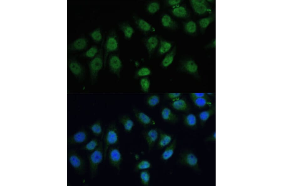 Immunofluorescence - Anti-CPS1 Antibody (A308500) - Antibodies.com