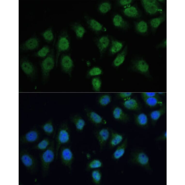 Immunofluorescence - Anti-CPS1 Antibody (A308500) - Antibodies.com