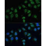 Immunofluorescence - Anti-CPS1 Antibody (A308500) - Antibodies.com